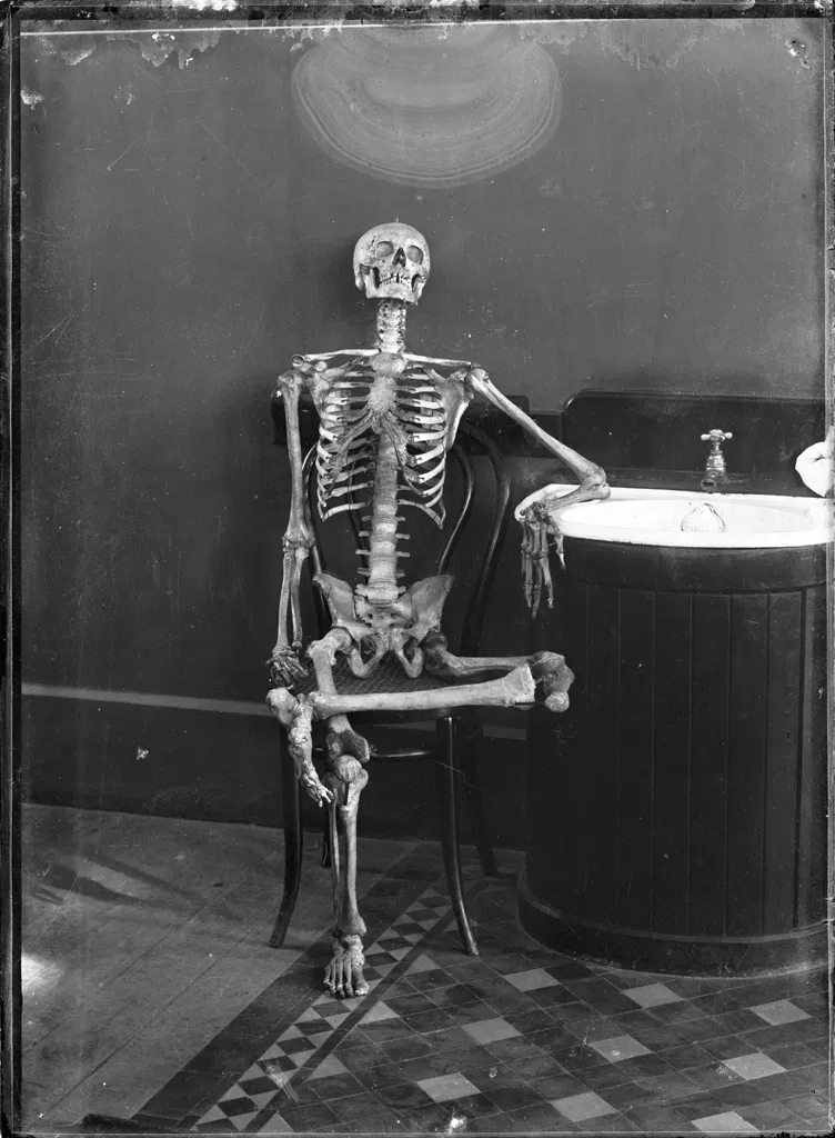An earyl 20th century photo of a human skeleton, posed casually seated beside a sink.